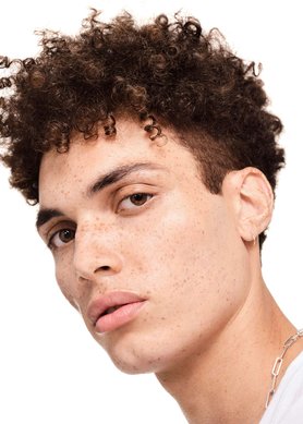 Mẹo-giữ-bình-tĩnh-khỏi-căng-thẳng-và-kiểm-soát-mụn-trứng-cá-hiệu-quả