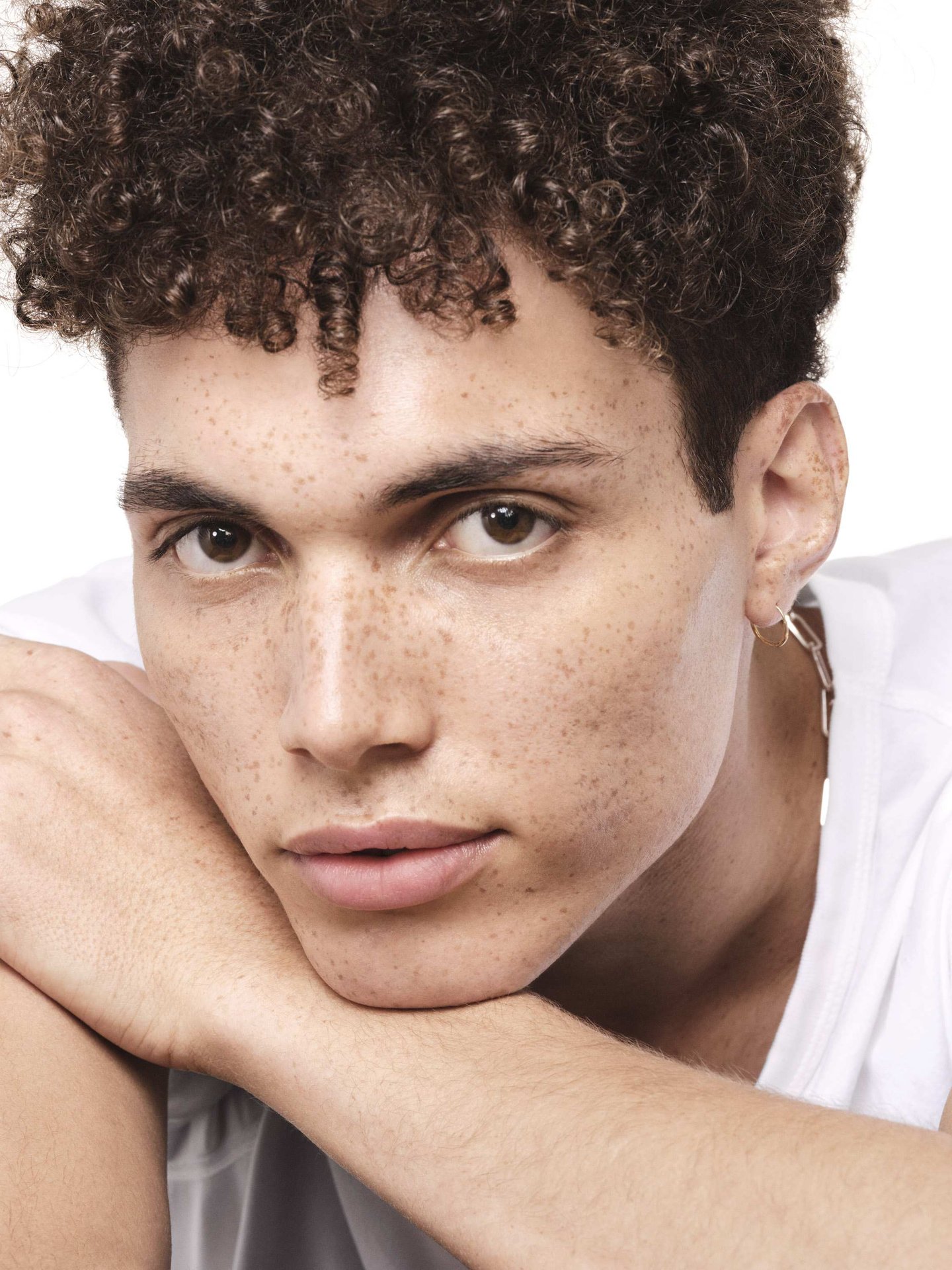 Mụn-mùa-đông:-cách-chăm-sóc-làn-da-khô-nhiều-khuyết-điểm