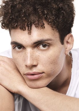 Mụn-mùa-đông:-cách-chăm-sóc-làn-da-khô-nhiều-khuyết-điểm