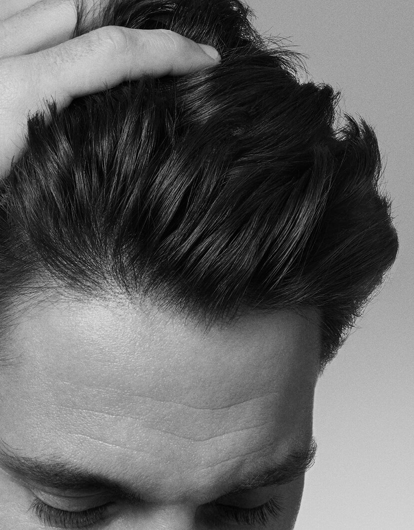 tất-tần-tật-bạn-cần-biết-về-gàu-bám-dính