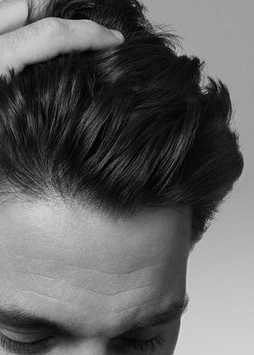 tất-tần-tật-bạn-cần-biết-về-gàu-bám-dính