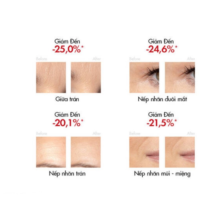 LIFTACTIV Retinol Serum chứng minh lâm sàng